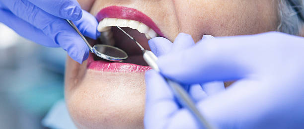 Best Emergency Tooth Extraction in Lakeland, TN